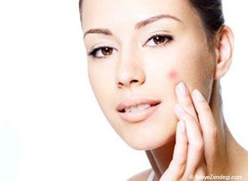  معرفی ماسک صورت خوب برای پوست بد 